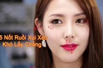 Video: Những nốt ruồi “ám quẻ” nên xóa nếu không muốn gánh họa cả đời