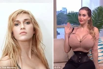 Video: Phẫu thuật thẩm mỹ 200 lần để thành búp bê Barbie