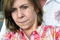 Cô bé 13 tuổi mang gương mặt phụ nữ 40 tuổi