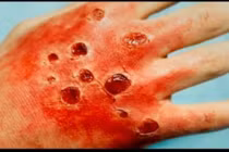 Những căn bệnh đáng sợ giết người chỉ trong một ngày