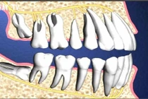 Video: Tại sao cơ thể lại có những bộ phận không cần thiết?