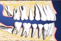 Video: Tại sao cơ thể lại có những bộ phận không cần thiết?