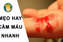 Tuyệt chiêu cầm máu nhanh ít người biết