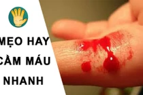 Tuyệt chiêu cầm máu nhanh ít người biết