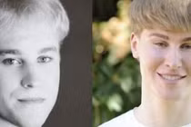 Chi 2 tỷ để phẫu thuật giống Justin Bieber