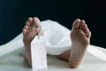 Người chết bỗng... ngồi dậy trong nhà xác BV Bạch Mai