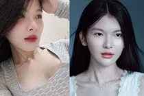 Danh tính nữ bác sỹ sở hữu vẻ đẹp thuần thiết nổi khắp MXH