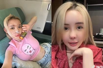 Netizen ngỡ ngàng với diện mạo khác lạ của Ngân 98 sau “dao kéo“