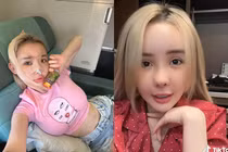 Netizen ngỡ ngàng với diện mạo khác lạ của Ngân 98 sau “dao kéo“