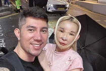 “Hot girl thị phi” Ngân 98 tiết lộ chi phí phẫu thuật thẩm mỹ