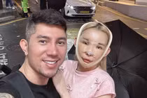 “Hot girl thị phi” Ngân 98 tiết lộ chi phí phẫu thuật thẩm mỹ