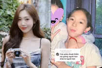 Gái xinh Đảo Thiên Đường lộ ảnh thời chưa tiêm filler, niềng răng