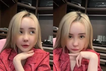 Ngân 98 hoàn thành phẫu thuật thẩm mỹ, các fan có yêu cầu lạ