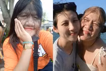 Diện mạo cô gái nhiều lông nhất thế giới khi cạo sạch lông mặt