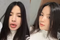 Netizen không nhận ra Chu Thanh Huyền sau khi phẫu thuật thẩm mỹ