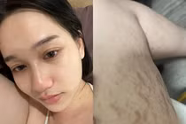 “Nữ thần Mắt biếc” công khai tình trạng khó tin khi tăng cân