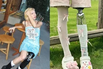 Nữ người mẫu mất một chân vẫn khiến fan mê đắm