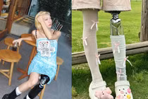 Nữ người mẫu mất một chân vẫn khiến fan mê đắm