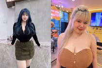 Nữ sinh Hải Dương từng phải phẫu thuật thu nhỏ vòng 1 giờ ra sao?