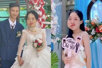 Cô gái mặt lệch từng bị chê ngoại hình, giờ chồng cưng hết mực