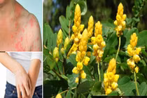 Bài thuốc chữa nhiều bệnh từ cây hoa muồng trâu mùa thu 