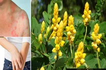 Bài thuốc chữa nhiều bệnh từ cây hoa muồng trâu mùa thu 