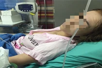 Sắp tiến hành ca chuyển giới đầu tiên tại Việt Nam