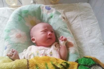 Cứu sống thai nhi và sản phụ mang thai ngoài tử cung cực hiếm