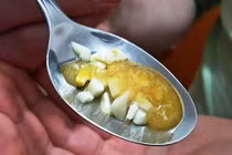 Cách làm nước uống phòng đau tim, đột quỵ từ chanh tỏi 