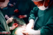 Đại phẫu kì diệu cứu sống chàng trai bị nghiền nát nửa người