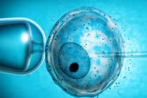 Trẻ sinh ra trong ống nghiệm dễ bị ung thư sớm