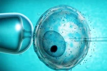 Trẻ sinh ra trong ống nghiệm dễ bị ung thư sớm