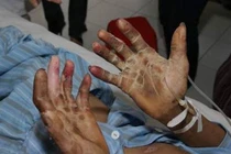 Nguy hiểm luôn cận kề người mê ăn đồ tái sống 