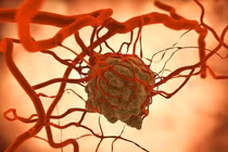 Phương pháp trị ung thư của học sinh Việt đoạt giải quốc tế