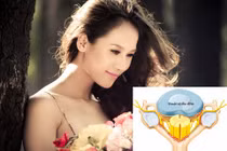 Căn bệnh của người mẫu Thái Hà có thể gây tàn phế