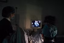 Cận cảnh kỹ thuật cấy phôi thai vào tử cung