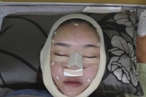 Lý giải buồn cười của Kỳ Hân về khuôn mặt bị sưng