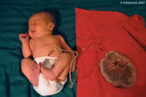 Rầm rộ mốt sinh con không cắt rốn ở phương Tây