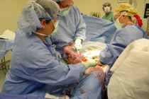 Những biến chứng sau khi mổ đẻ cực kì nguy hiểm