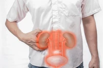 Loạt dấu hiệu nguy cơ suy thận đừng thờ ơ