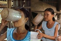 Nỗi thống khổ các thiếu nữ ăn uống vô độ như cô gái Quảng Nam