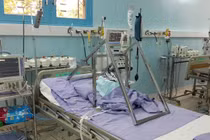 Tách 2 trẻ sơ sinh: 1 bé biến chứng bất thường