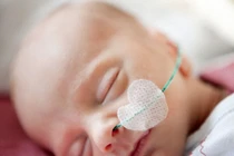 5 hiểm họa đe dọa những em bé sơ sinh suy dinh dưỡng