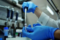 Việt Nam công bố phương pháp mới chữa được ung thư