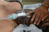 Hai người tổn thương não nặng do say nắng say nóng