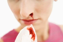 Dấu hiệu ung thư dễ bị bỏ qua vì tưởng bệnh vặt