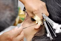 Lấy ráy tai khi cắt tóc, gội đầu: Nữ sinh nhập viện