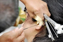 Lấy ráy tai khi cắt tóc, gội đầu: Nữ sinh nhập viện