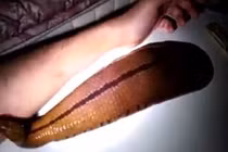 Dùng máu của mình nuôi đỉa khổng lồ như thú cưng