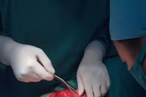 Liên tiếp phẫu thuật thành công nhiều ca bệnh hiếm đầu năm 2017